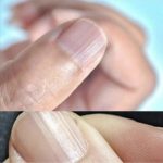 HAVING Striped Nails Could Mean That Your Body Is…. See more