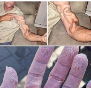 Homem is going to be worried and ends up feeling a strength in his arm, it was a… See More